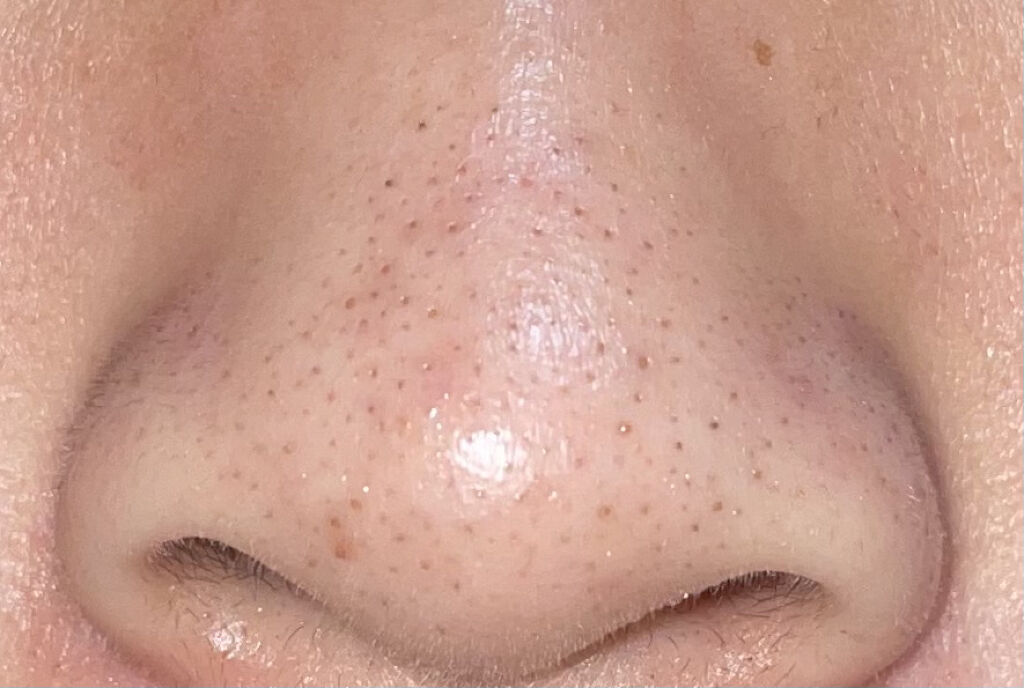 クレンジングバーム/ink./クレンジングバームを使ったクチコミ（1枚目）