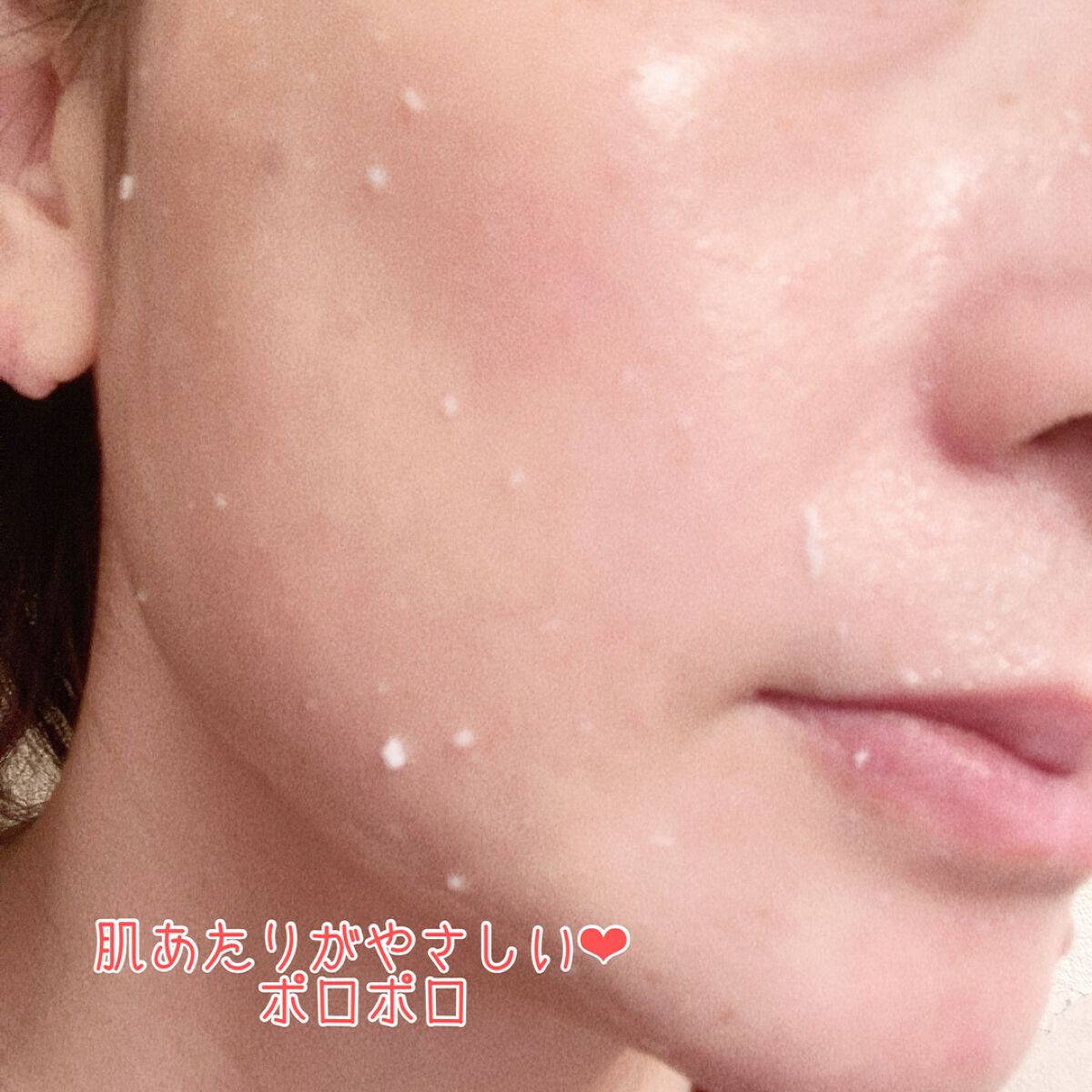 美白乃美人ピーリングジェル/ブレーンコスモス/ピーリングを使ったクチコミ(3枚目)