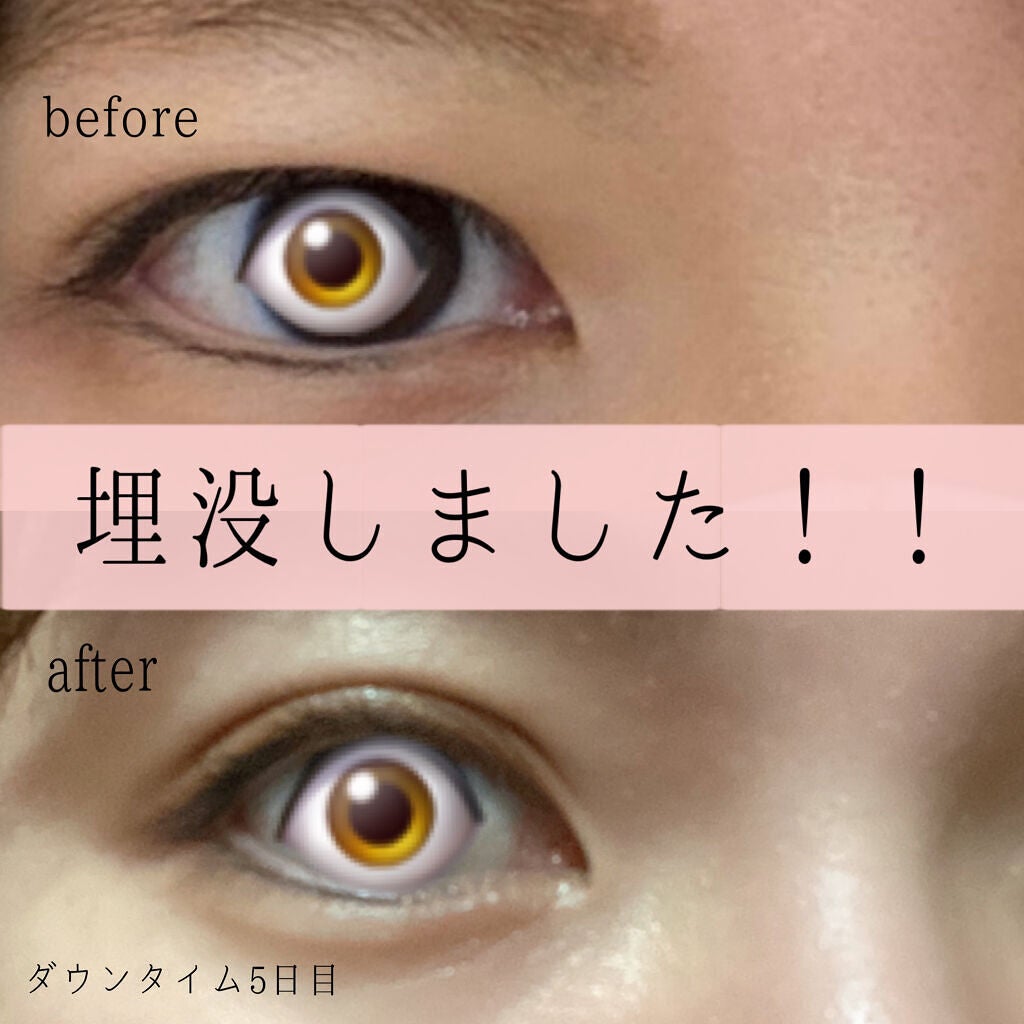 nanohaðŒ on LIPS ãå·Šå³ã®äºéå¹
ãå
šç¶éããŠãå·Šç®ã¯å¹
çå¹³è¡äºéã ã£ãã®ã§ãããå³..ãïŒ1æç®ïŒ