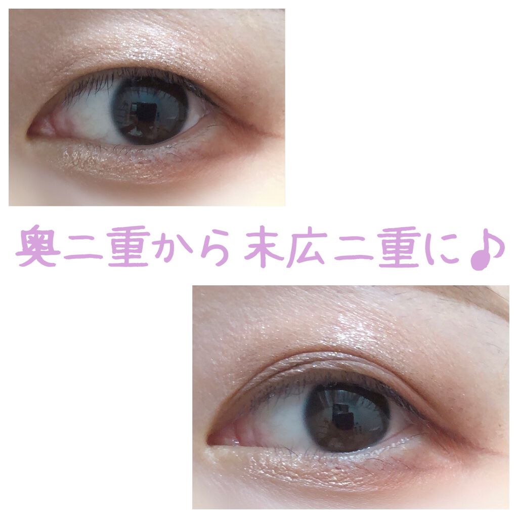 ワンダーアイリッドテープ Extra/D-UP/二重まぶた用アイテムを使ったクチコミ(1枚目)