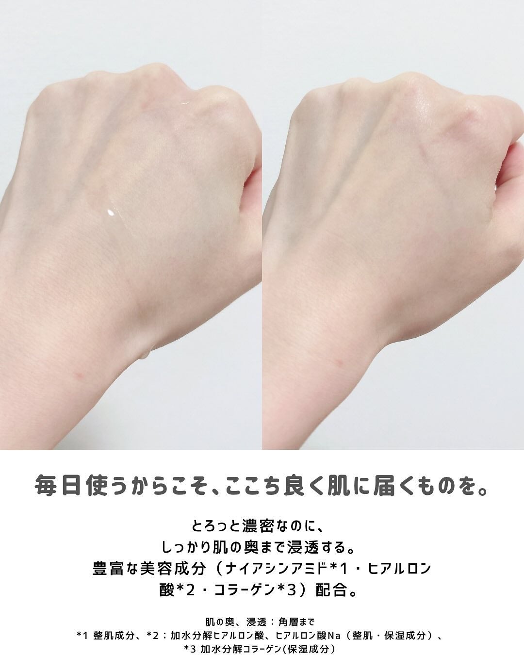 VC100エッセンスローション EX/ドクターシーラボⓇ/化粧水を使ったクチコミ(3枚目)