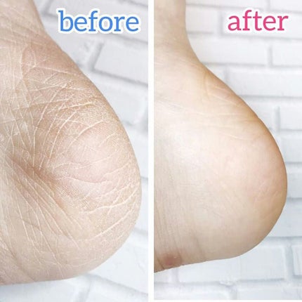 カカトリーヌモイストローション/KAKATOrine/レッグ・フットケアを使ったクチコミ(2枚目)