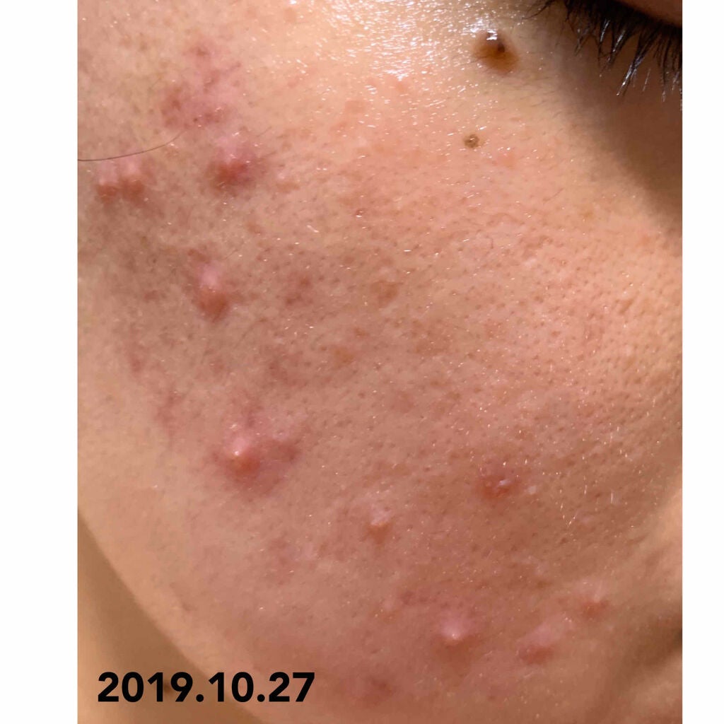 佐藤 あすか on LIPS 「お目汚し失礼します!1億年ぶりぐらいの投稿になります!なんとこ..」(2枚目)