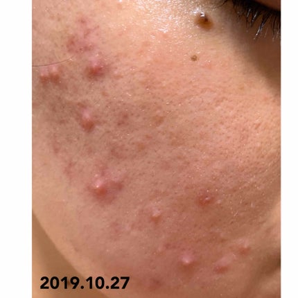 を使ったクチコミ(2枚目)