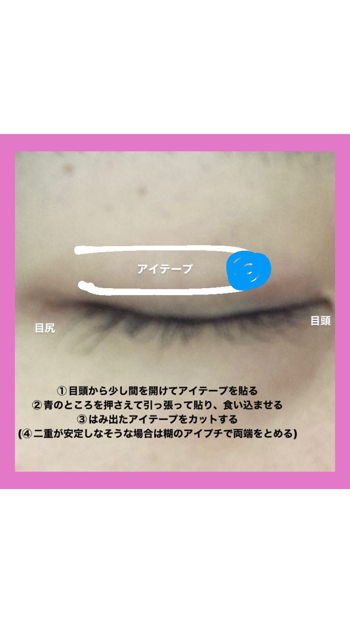 アイトーク/アイトーク/二重まぶた用アイテムを使ったクチコミ(2枚目)