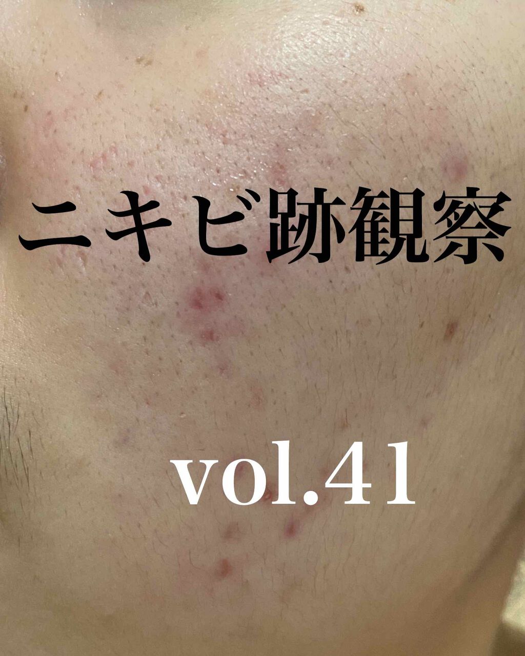 化粧水 NA/なめらか本舗/化粧水を使ったクチコミ（1枚目）