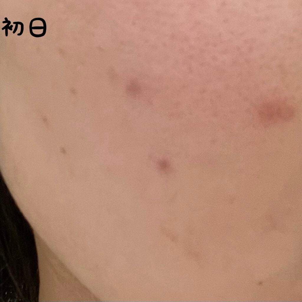 ハイドロクリーム SHQ-10/KISO/フェイスクリームを使ったクチコミ(2枚目)