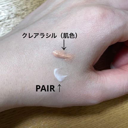 ペアアクネクリームW(医薬品)/ペア/その他を使ったクチコミ(2枚目)