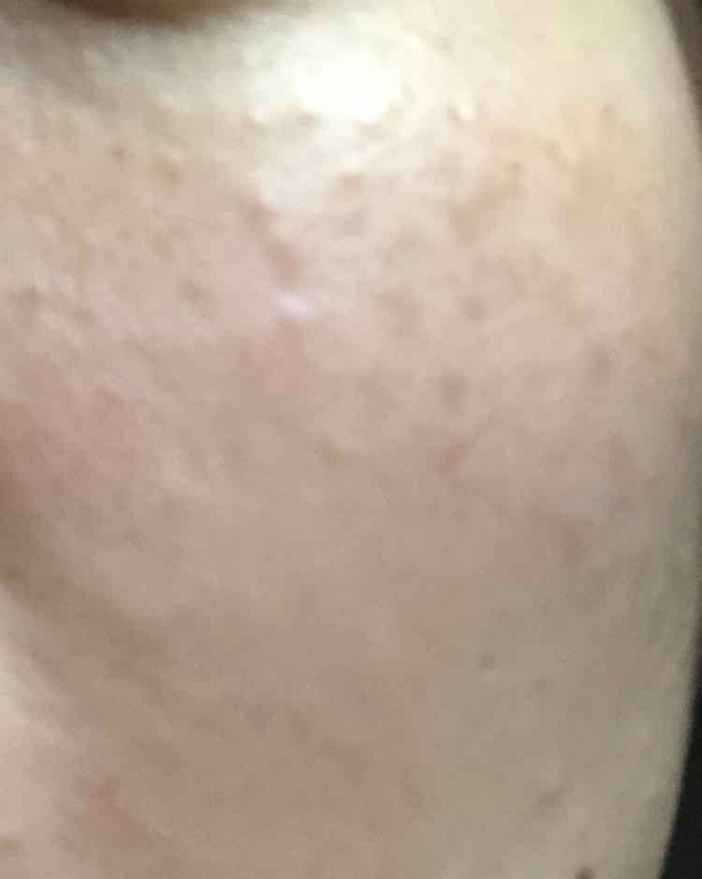 デュオ ザ クレンジングバーム ホワイトa/DUO/クレンジングバームを使ったクチコミ(1枚目)