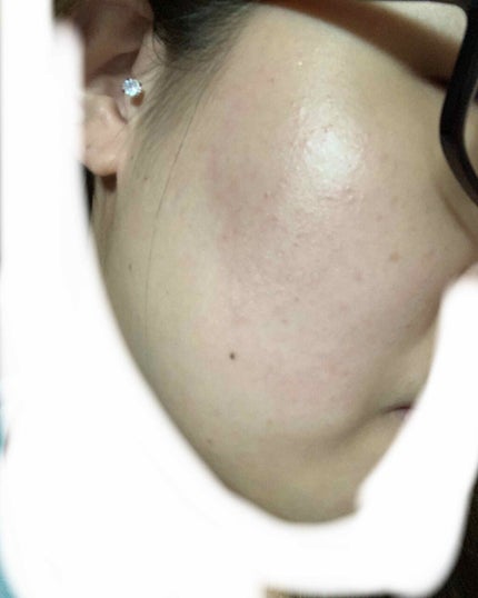 ハトムギ化粧水(ナチュリエ スキンコンディショナー R )/ナチュリエ/化粧水を使ったクチコミ(1枚目)