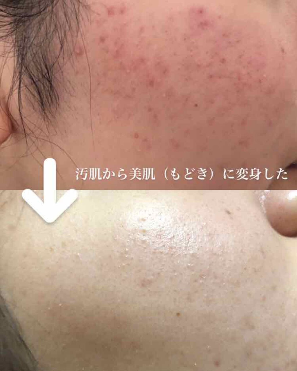 ハトムギ洗顔フォーム/麗白/洗顔フォームを使ったクチコミ（1枚目）