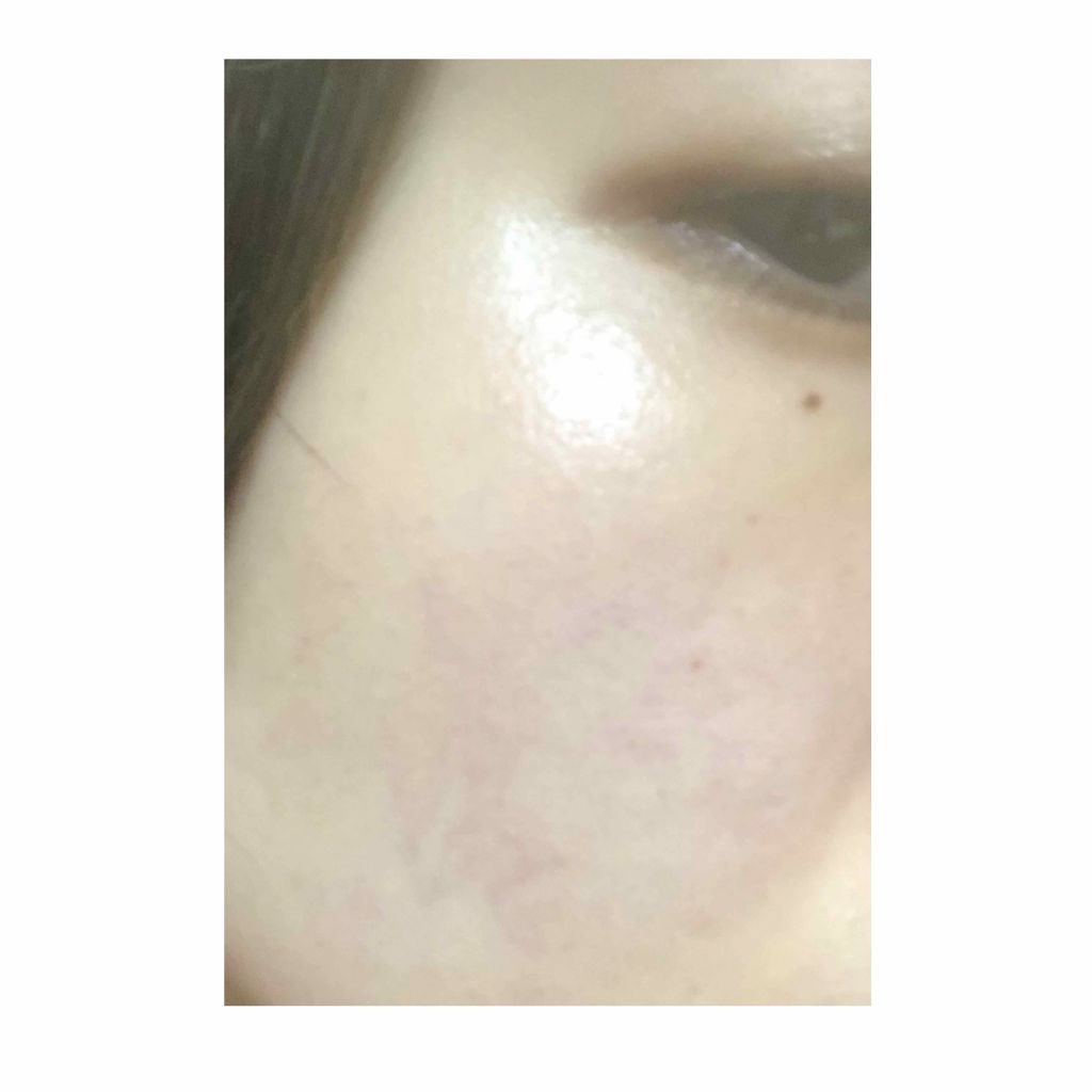 ネイチャーコンク 薬用 クリアローションとてもしっとり/ネイチャーコンク/拭き取り化粧水を使ったクチコミ(2枚目)