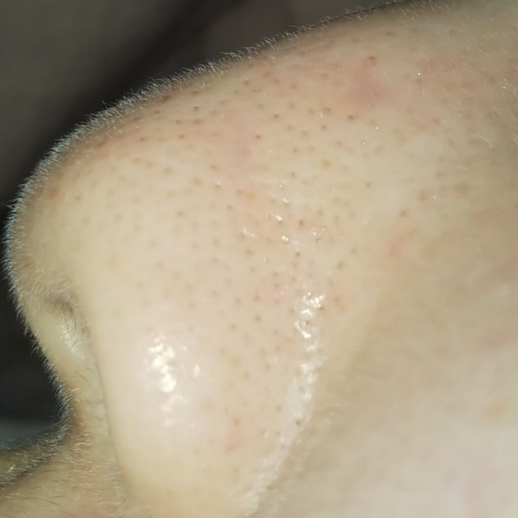 DHC ビタミンCハードカプセル/DHC/美容サプリメントを使ったクチコミ(3枚目)