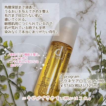 アクネケア ローション MB/d プログラム/化粧水を使ったクチコミ(4枚目)