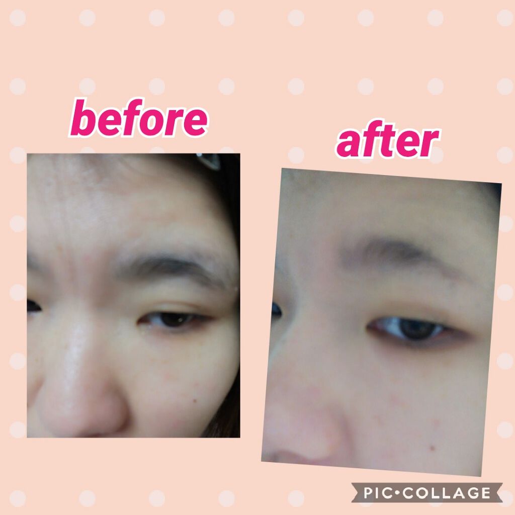 脱色クリーム 敏感肌用/エピラット/ムダ毛ケアを使ったクチコミ（2枚目）