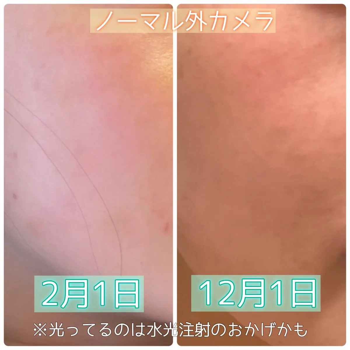 AGE-R ブースタープロ/MEDICUBE/美顔器・マッサージを使ったクチコミ（2枚目）