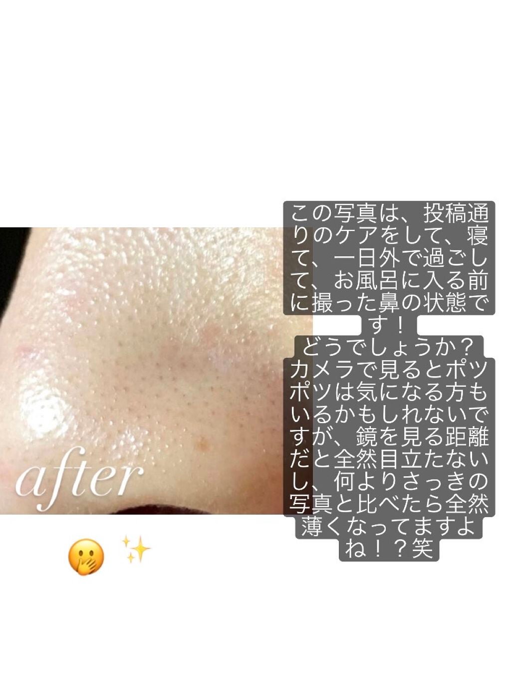 ma__chan on LIPS 「⚠️今回私が紹介するのは「無理矢理」でもいちご鼻を消したい!!..」(3枚目)