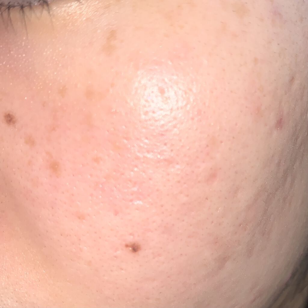 クリアウォッシュ/オルビス/洗顔フォームを使ったクチコミ（2枚目）