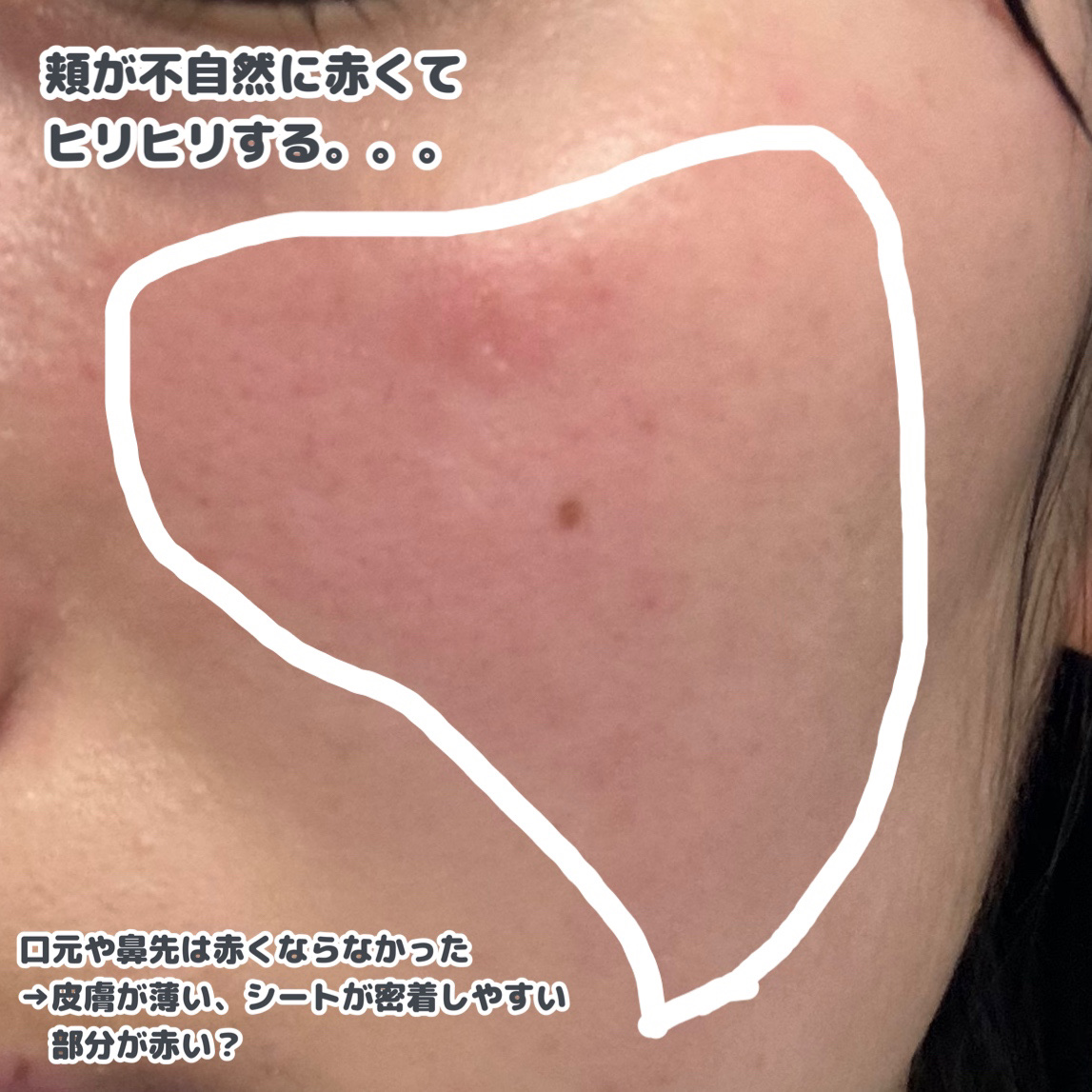 薬用ローション（とてもしっとり）/IHADA/化粧水を使ったクチコミ（2枚目）