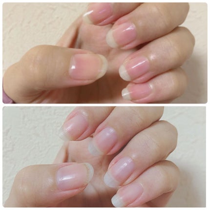 キューティクルオイル ローズ/MDS/ネイルオイル・トリートメントを使ったクチコミ(3枚目)