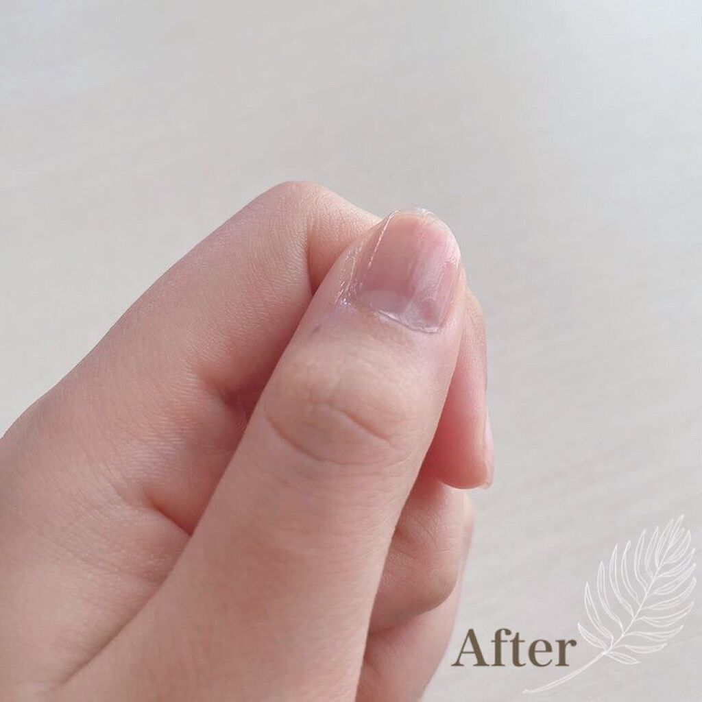 SHキューティクルリムーバーオイル/セリア/ネイルオイル・トリートメントを使ったクチコミ(4枚目)