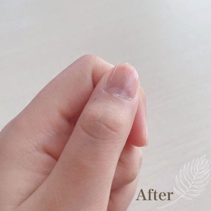 SHキューティクルリムーバーオイル/セリア/ネイルオイル・トリートメントを使ったクチコミ(4枚目)