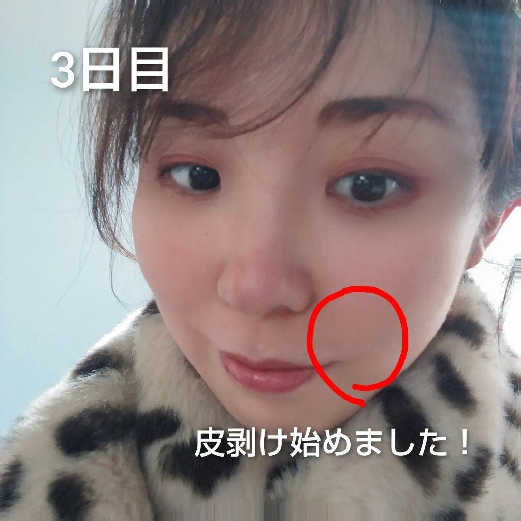 ゆなcc:フォロバ100 on LIPS 「BQCELLダーマスキンケアピーリング🎊1week体験投稿🎊1..」(4枚目)