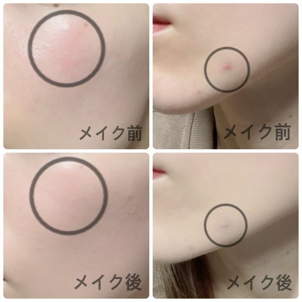 UR GLAM CONCEALER PALETTE/U R GLAM/パレットコンシーラーを使ったクチコミ(3枚目)