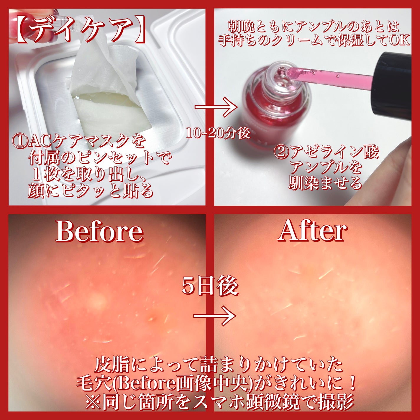 レッドブースター リードルショット100/VT/ブースター・導入液を使ったクチコミ(6枚目)