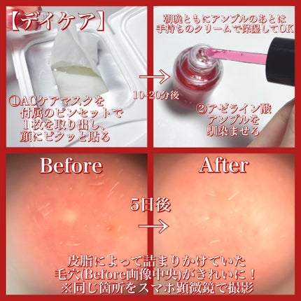 レッドブースター リードルショット100/VT/ブースター・導入液を使ったクチコミ(6枚目)