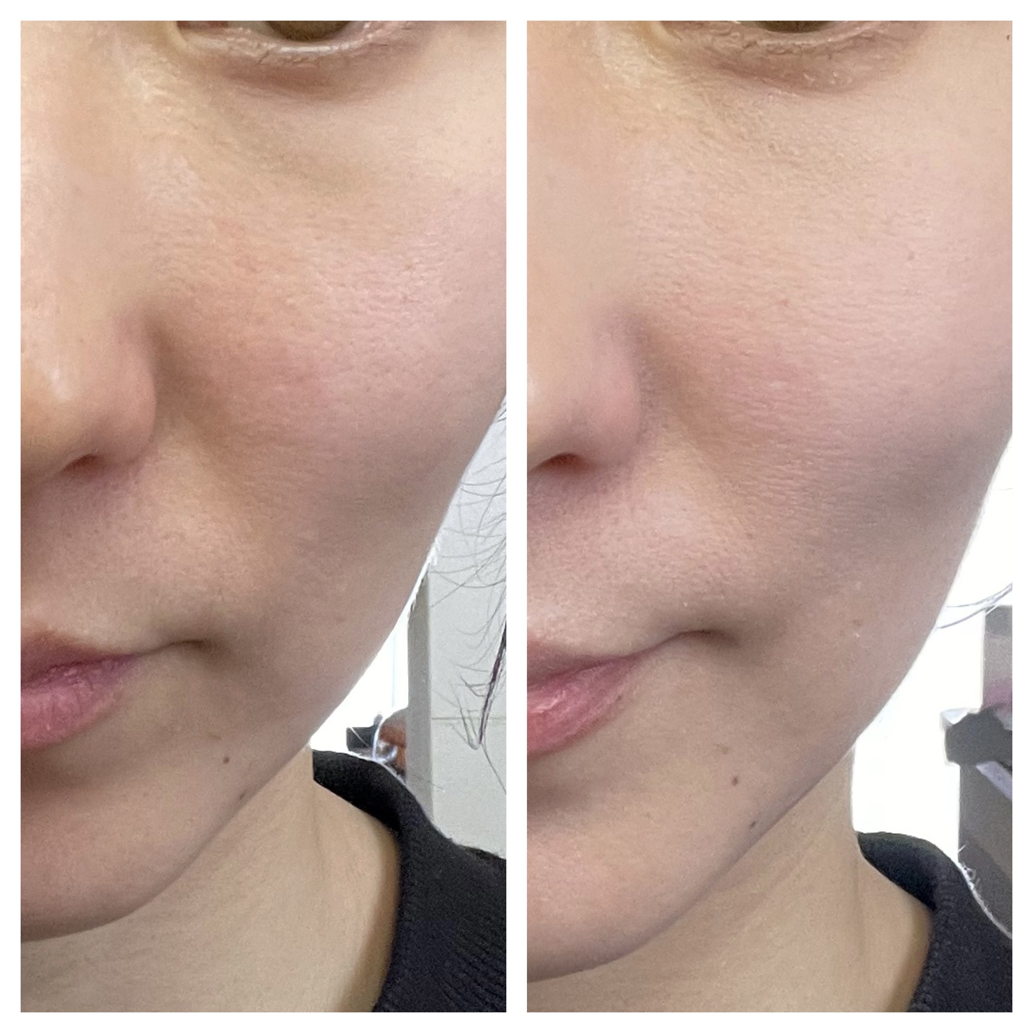 ブライトニングUV ジェル N/アネッサ/化粧下地を使ったクチコミ（2枚目）