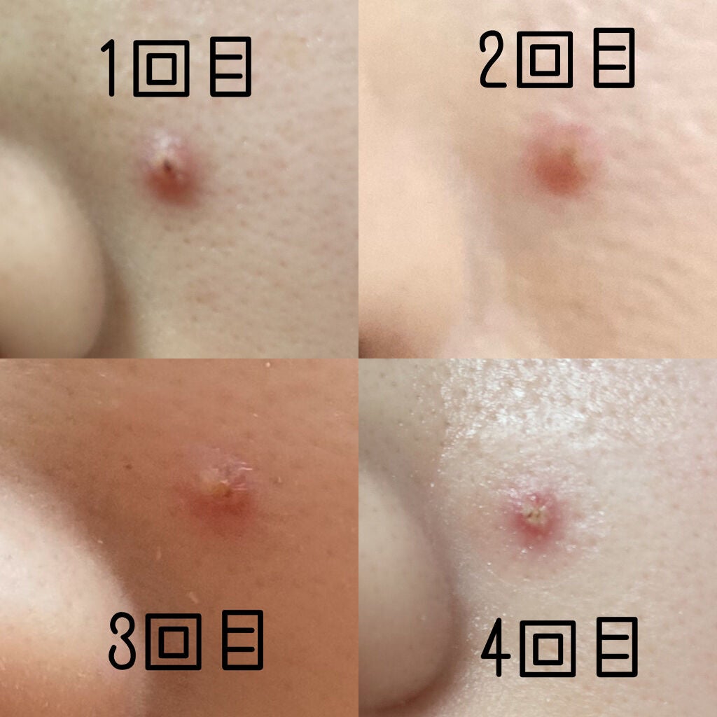 トラブルキュア/美肌ファクトリー/シートマスク・パックを使ったクチコミ(3枚目)