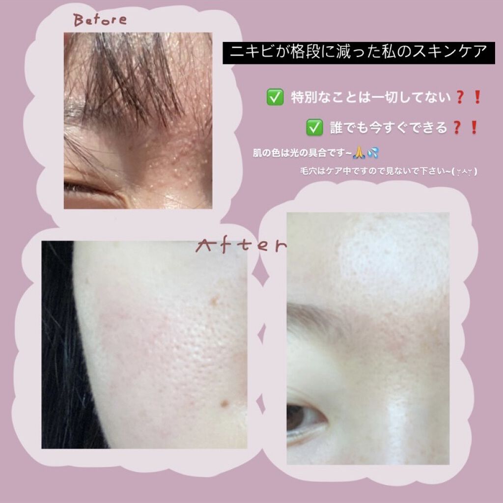 ハトムギ保湿ジェル(ナチュリエ スキンコンディショニングジェル)/ナチュリエ/美容液を使ったクチコミ（1枚目）