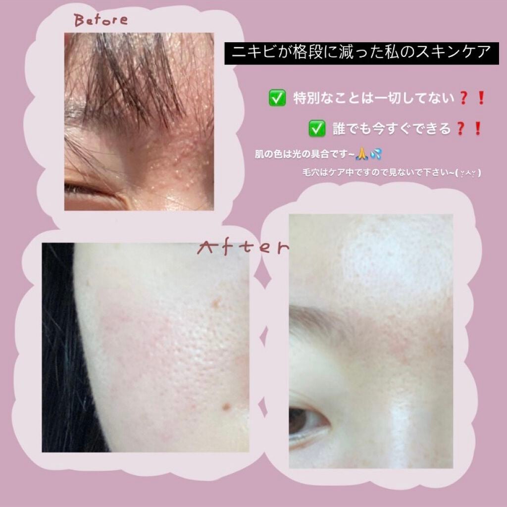 ハトムギ保湿ジェル(ナチュリエ スキンコンディショニングジェル)/ナチュリエ/美容液を使ったクチコミ(1枚目)