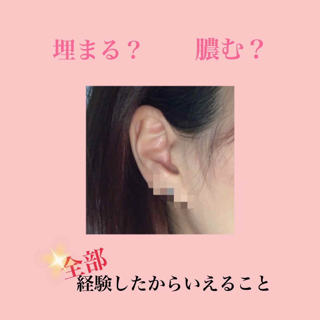 ドルマイシン軟膏(医薬品)/ゼリア新薬工業/その他を使ったクチコミ（1枚目）