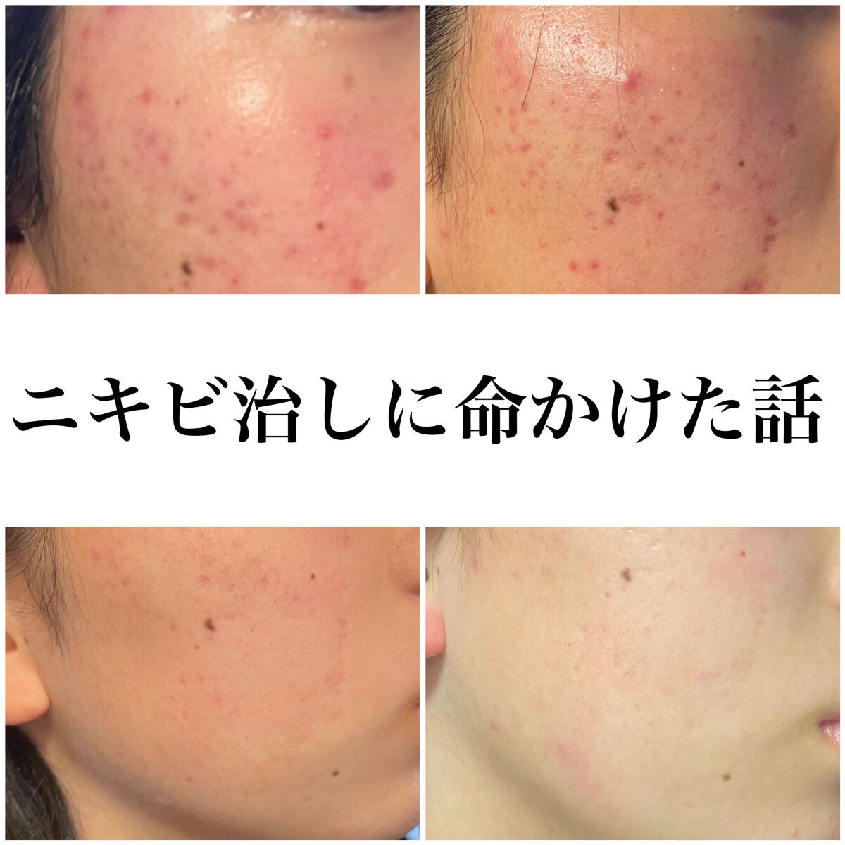 グーダルVクリーム(goodal GREEN TANGERINE V CREAM SET)/goodal/フェイスクリームを使ったクチコミ(1枚目)