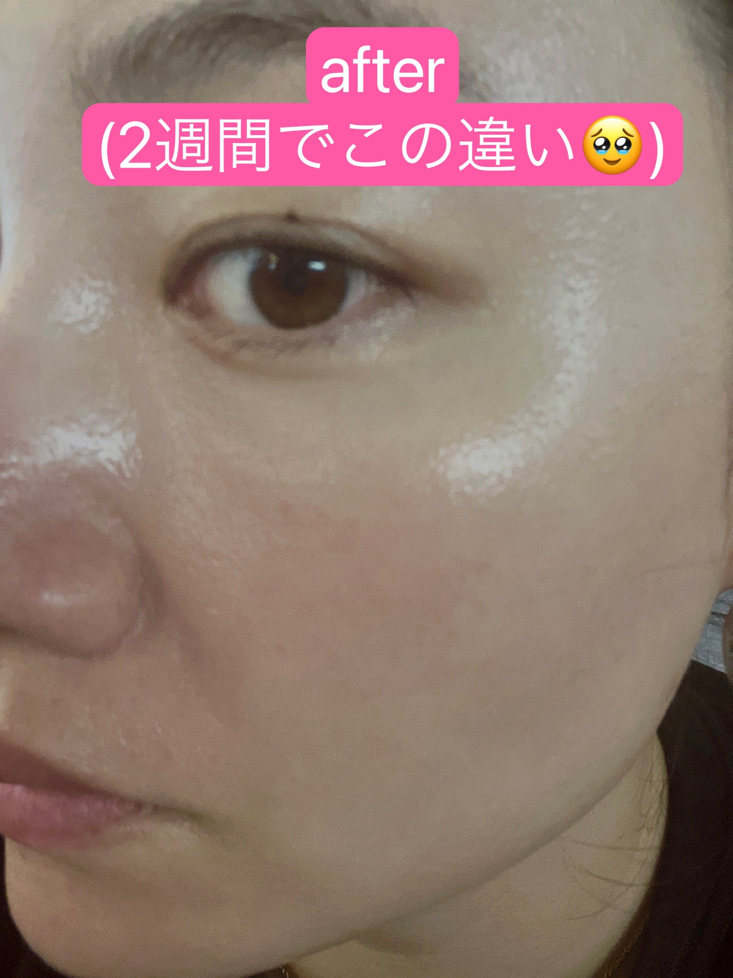 ユース ラディアンス ビタチノール セラム/primera/美容液を使ったクチコミ(4枚目)