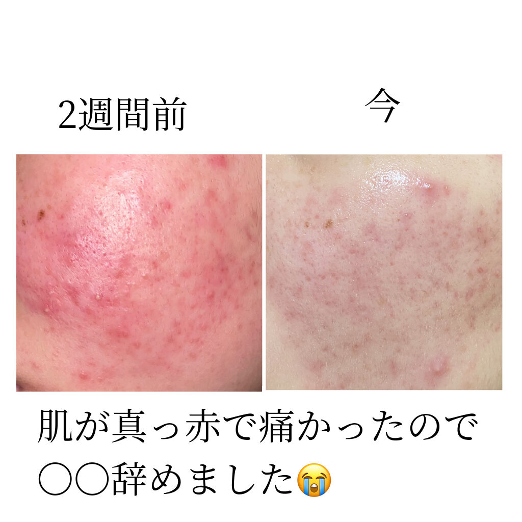 ほいっぷるん/DAISO/その他スキンケアグッズを使ったクチコミ（1枚目）