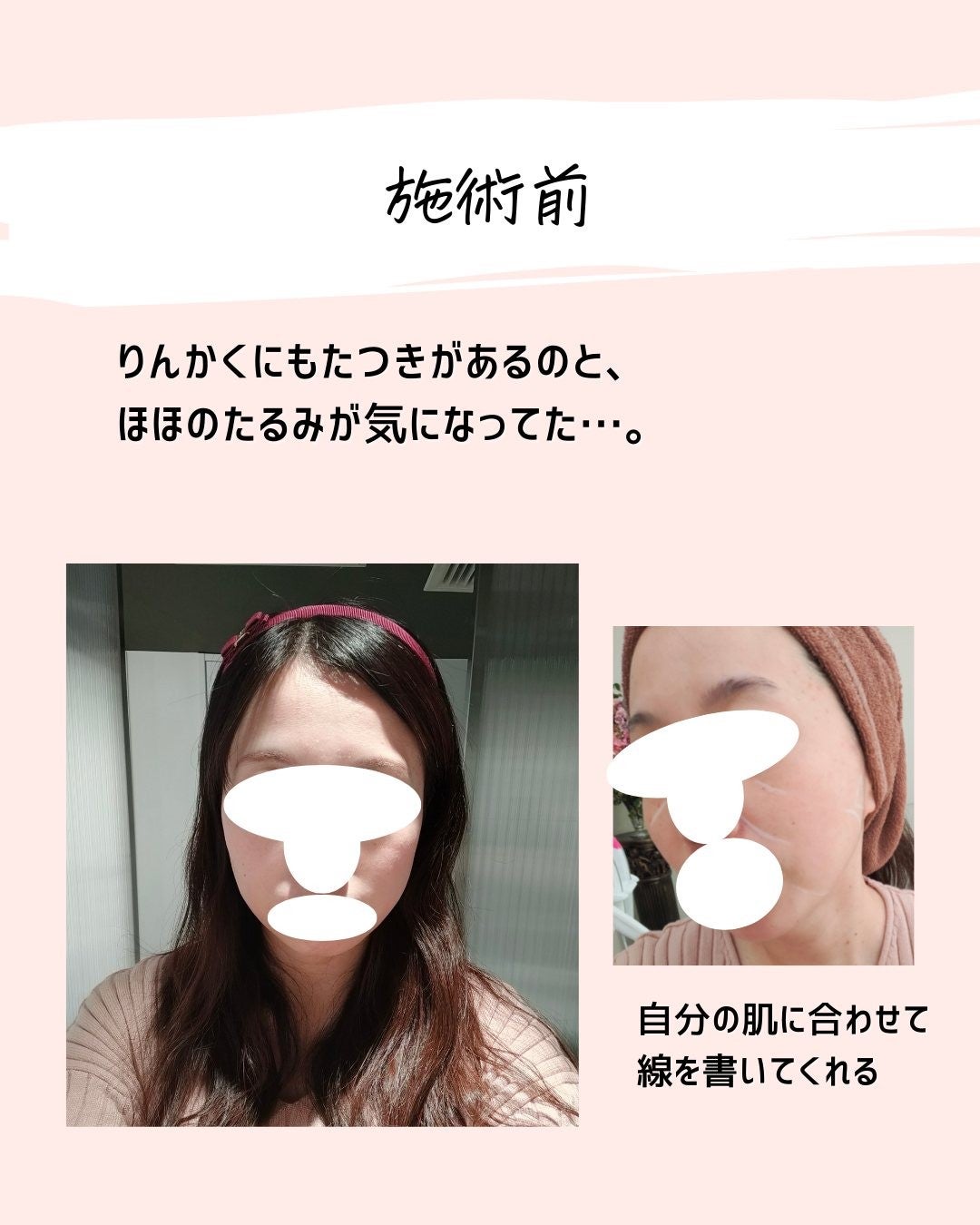 とまと村長@化粧品研究者 on LIPS 「←肌ケアをしたい人はフォロー必須🍅化粧品研究者のとまと村長です..」(5枚目)