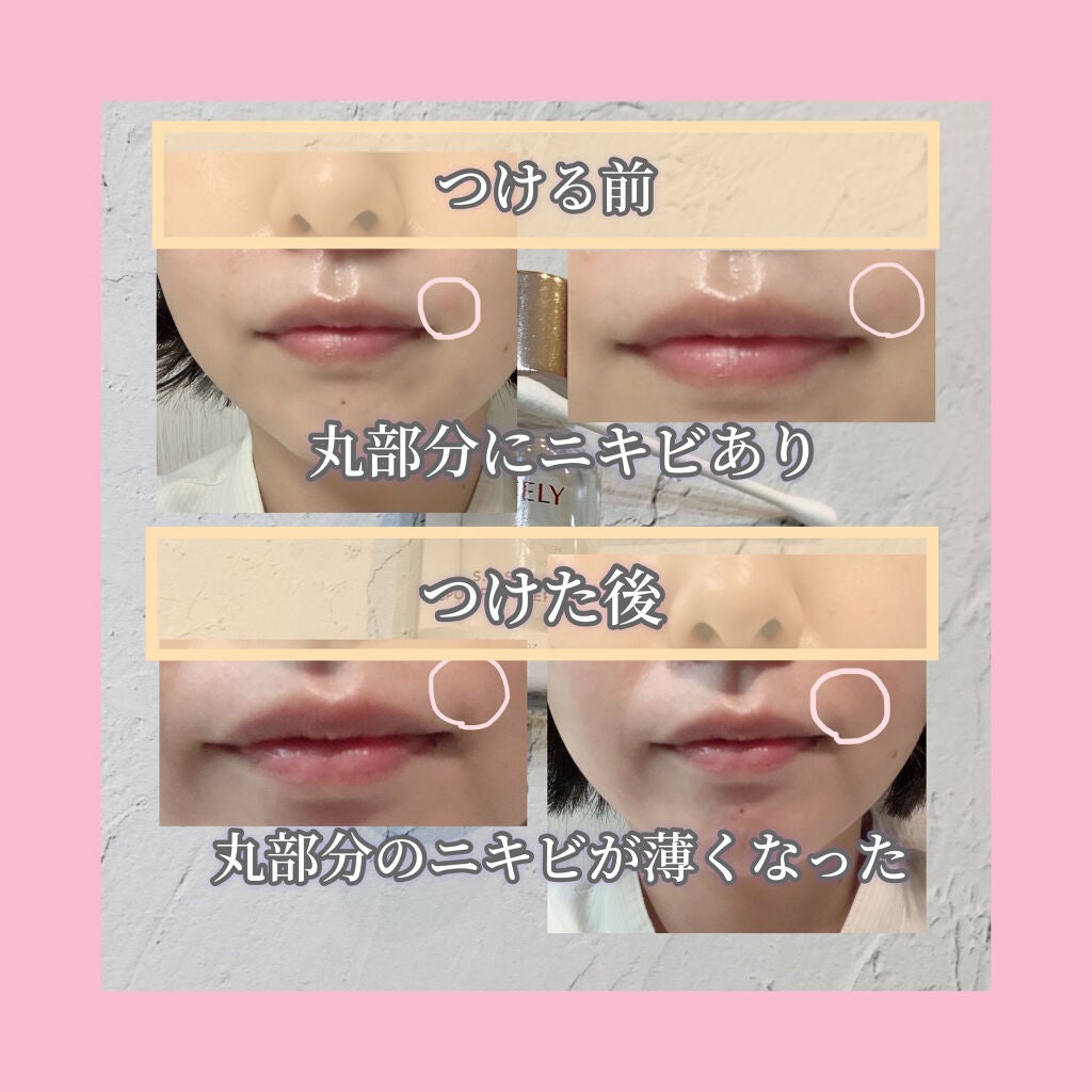 S.O.S スポットパウダー/VELY VELY/その他スキンケアを使ったクチコミ(2枚目)