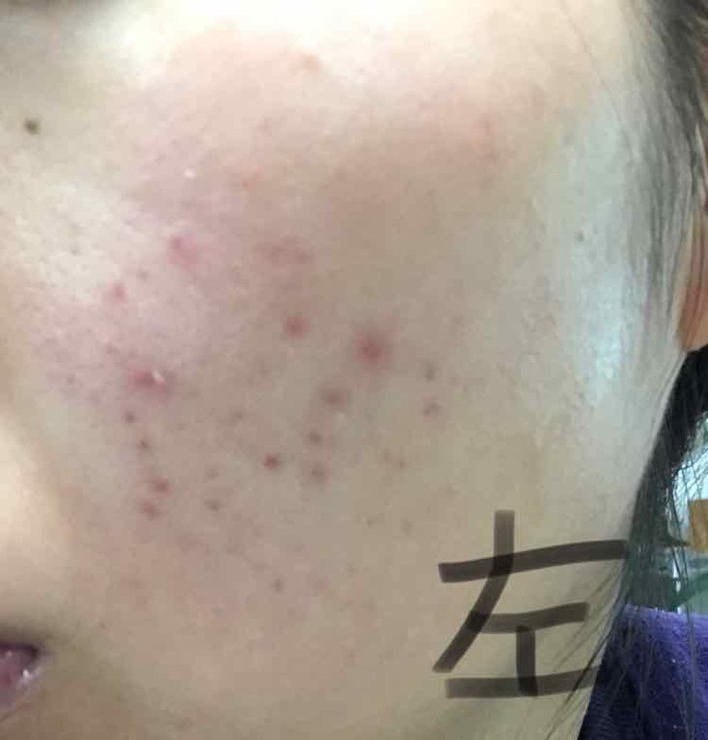 DHC ビタミンBミックス/DHC/美容サプリメントを使ったクチコミ（3枚目）