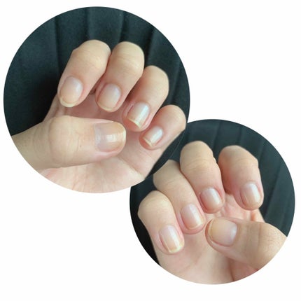 ネイルトリートメント N/ネイルネイル/ネイルオイル・トリートメントを使ったクチコミ(2枚目)