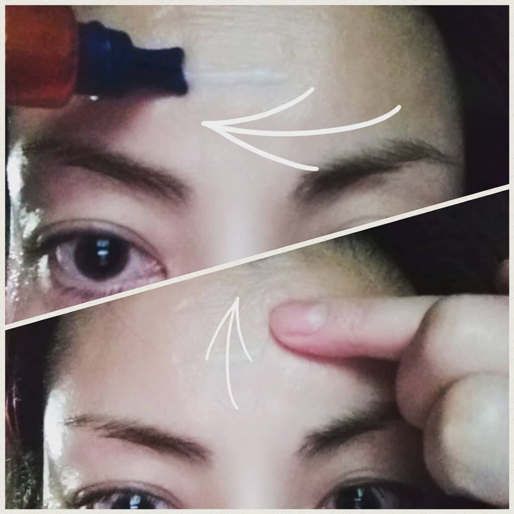 リンクルショット メディカル セラム N/リンクルショット/アイケア・アイクリームを使ったクチコミ（2枚目）