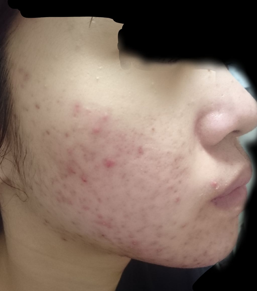 ビジャ シカバーム EX/innisfree/フェイスバームを使ったクチコミ(2枚目)