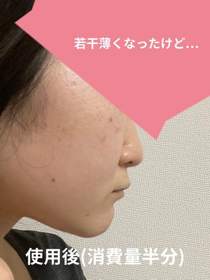 美白美容液 W/ちふれ/美容液を使ったクチコミ(3枚目)