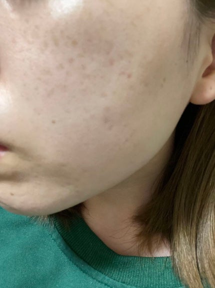 モイスチャー リッチローション(とてもしっとり)/アルージェ/化粧水を使ったクチコミ(3枚目)