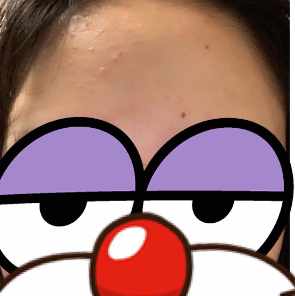 ペアA錠 (医薬品)/ペア/その他を使ったクチコミ（1枚目）