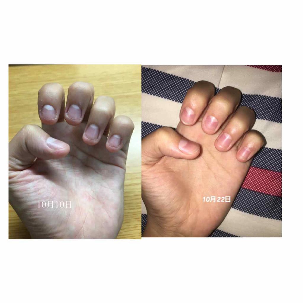 オリジナル ピュアスキンジェリー/ヴァセリン/ボディクリームを使ったクチコミ（3枚目）