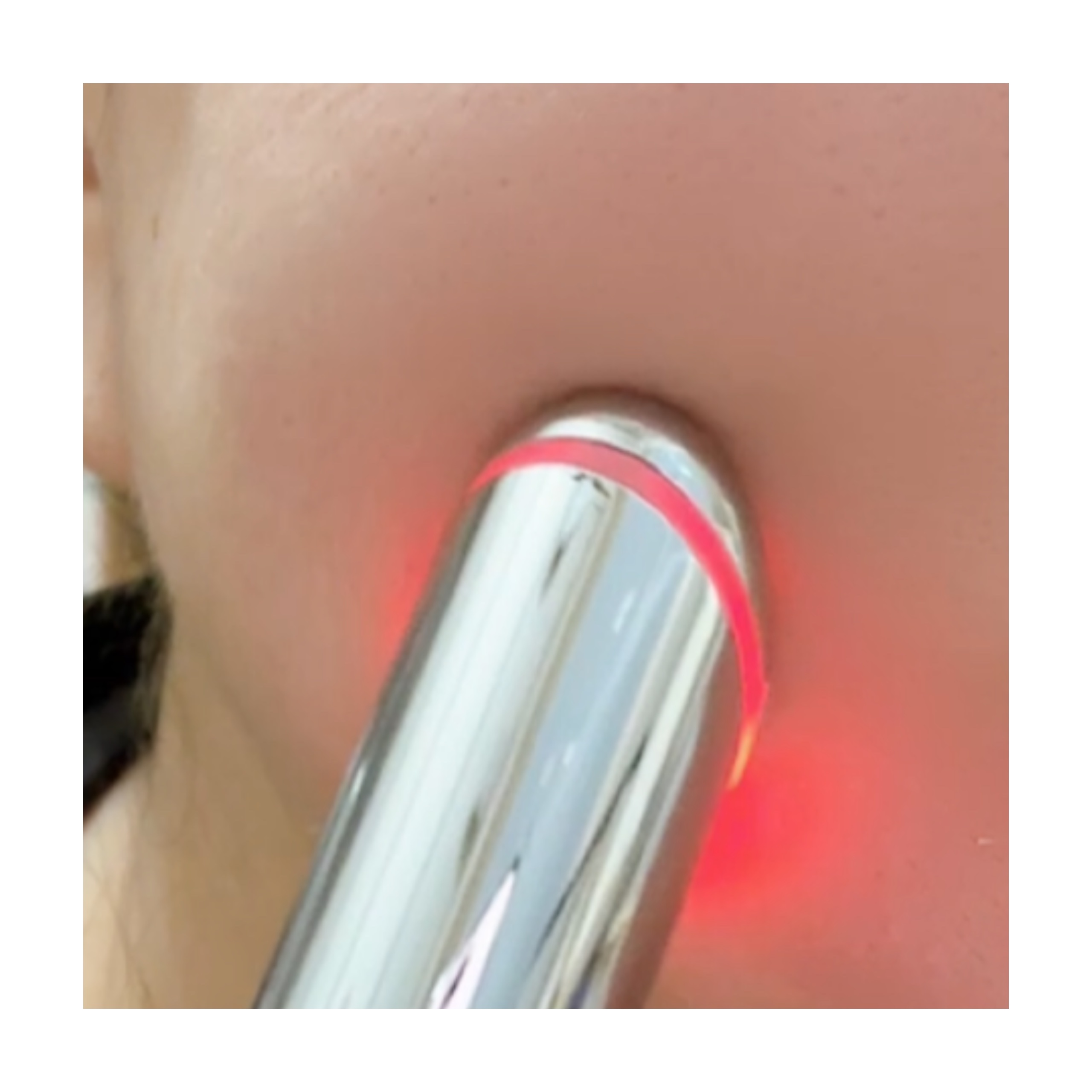 エンリッチドアイクリーム/ANLAN/フェイスクリームを使ったクチコミ（3枚目）