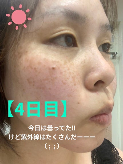 ケシミン クリームj/ケシミン/その他スキンケアを使ったクチコミ(1枚目)